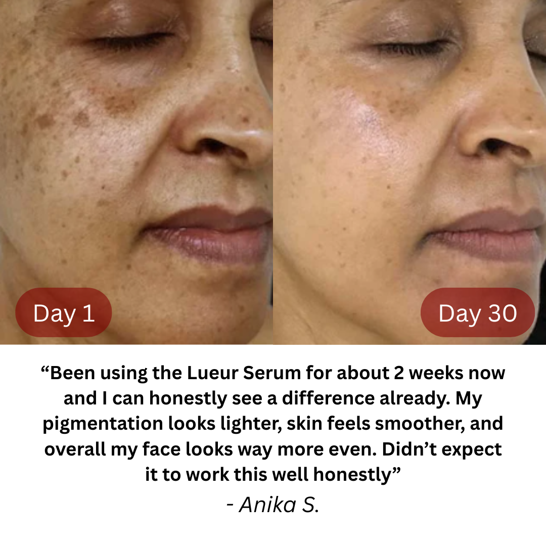 Lueur Pigment Repair Serum