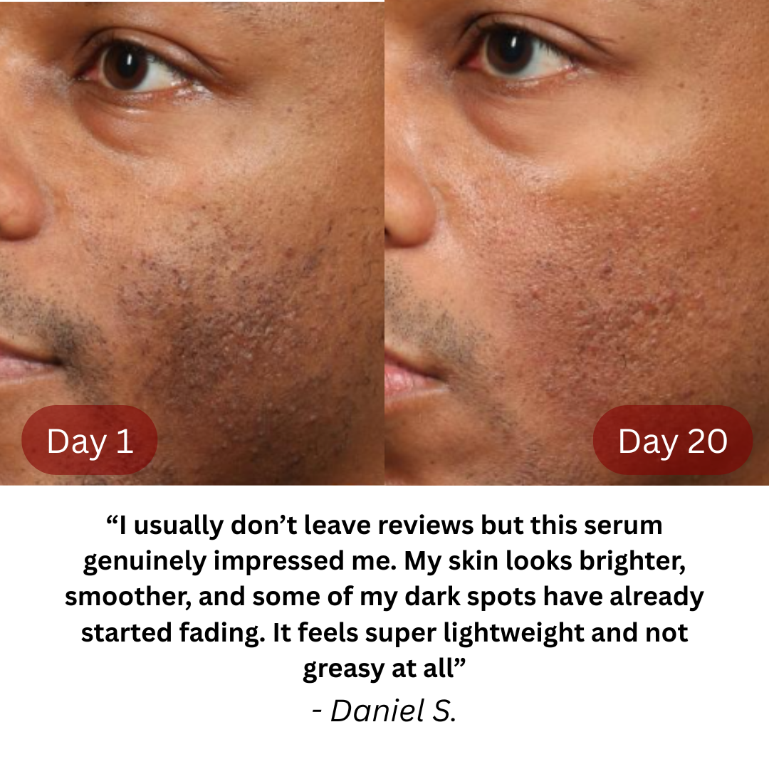 Lueur Pigment Repair Serum